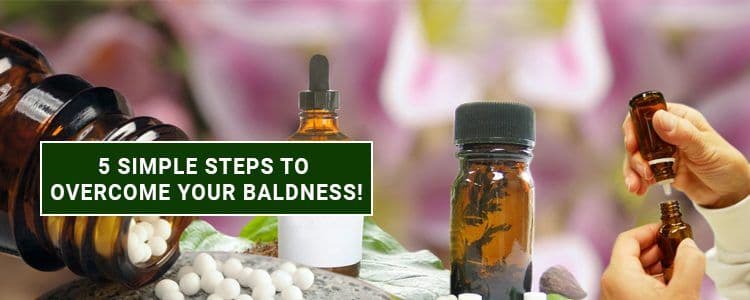 Featured image for 5-simple-steps-to-overcome-your-baldness