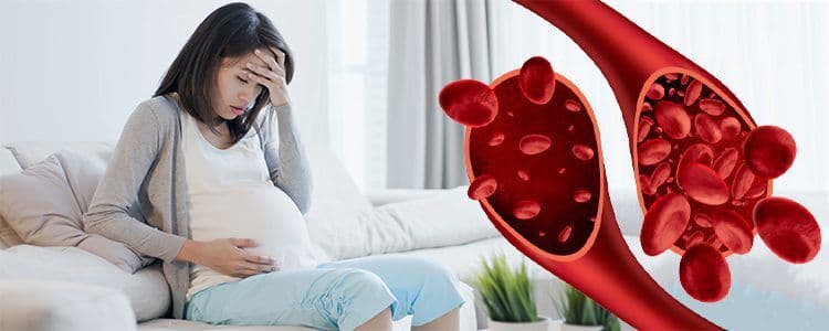 Featured image for anemia-during-pregnancy-causes-symptoms-and-treatment