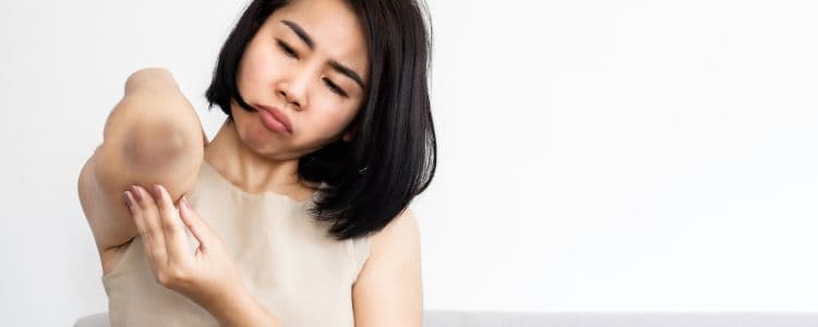 Are Dark Elbows Normal? Causes, Remedies, and How to Brighten Them Fast