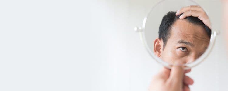 Featured image for early-signs-of-baldness-and-how-to-stop-them-with-homeopathy