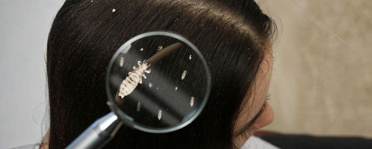 Head Lice in Kids: What Causes Them, Myths, and How to Care for Them