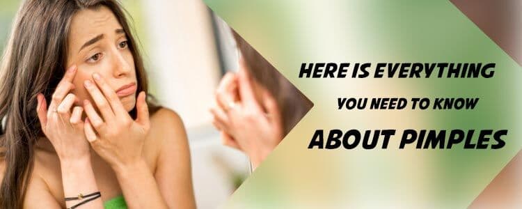 Featured image for here-is-everything-you-need-to-know-about-pimples