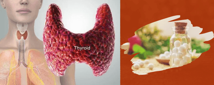 ISHOMEOPATHICTREATMENTEFFECTIVEFORTHYROID