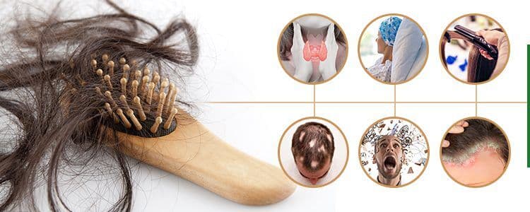 Featured image for losing-hair-reasons-why-youre-losing-your-hair