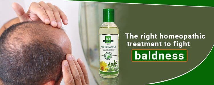 Featured image for the-right-homeopathic-treatment-to-fight-baldness