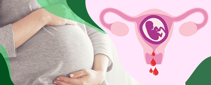 VaginalBleedingDuringEarlyPregnancyCausesTreatment