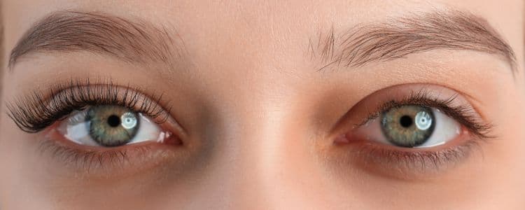 What Causes Dark Circles Under Eyes & How to Fix Them