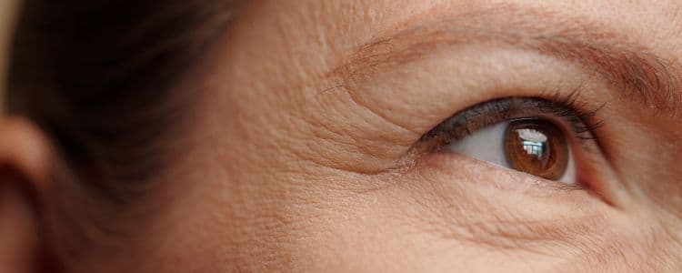 Wrinkles at Every Age: Causes, Treatments & Natural Remedies
