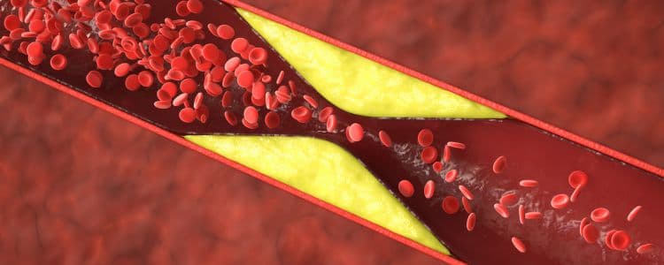 Young with High Cholesterol? Key Symptoms and What You Can Do Now